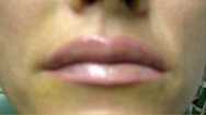 Lips