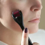 Microneedling: A Path to Rejuvenated Skin in Orlando