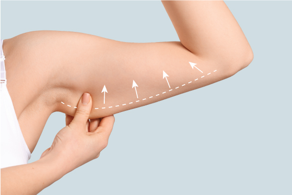 Arm Lift Costs in Orlando